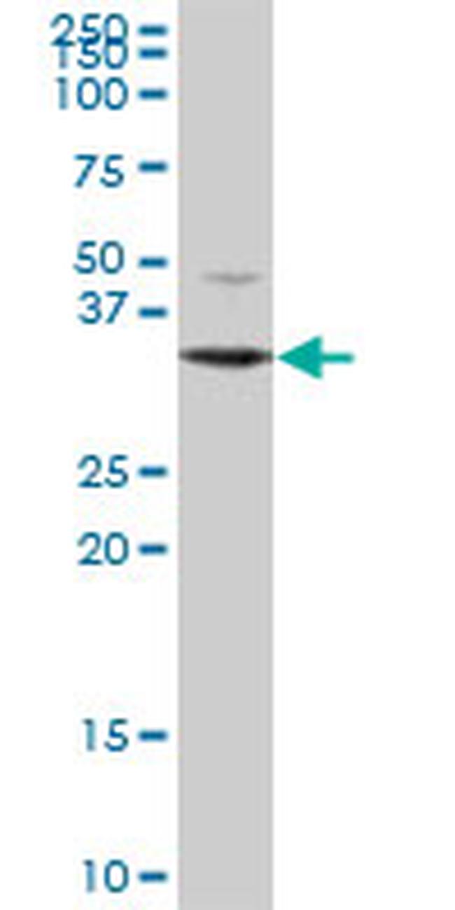 DECR2 Antibody in Western Blot (WB)