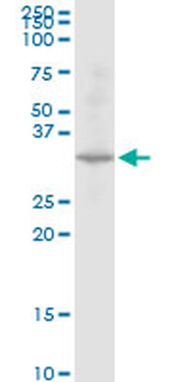 DECR2 Antibody in Western Blot (WB)