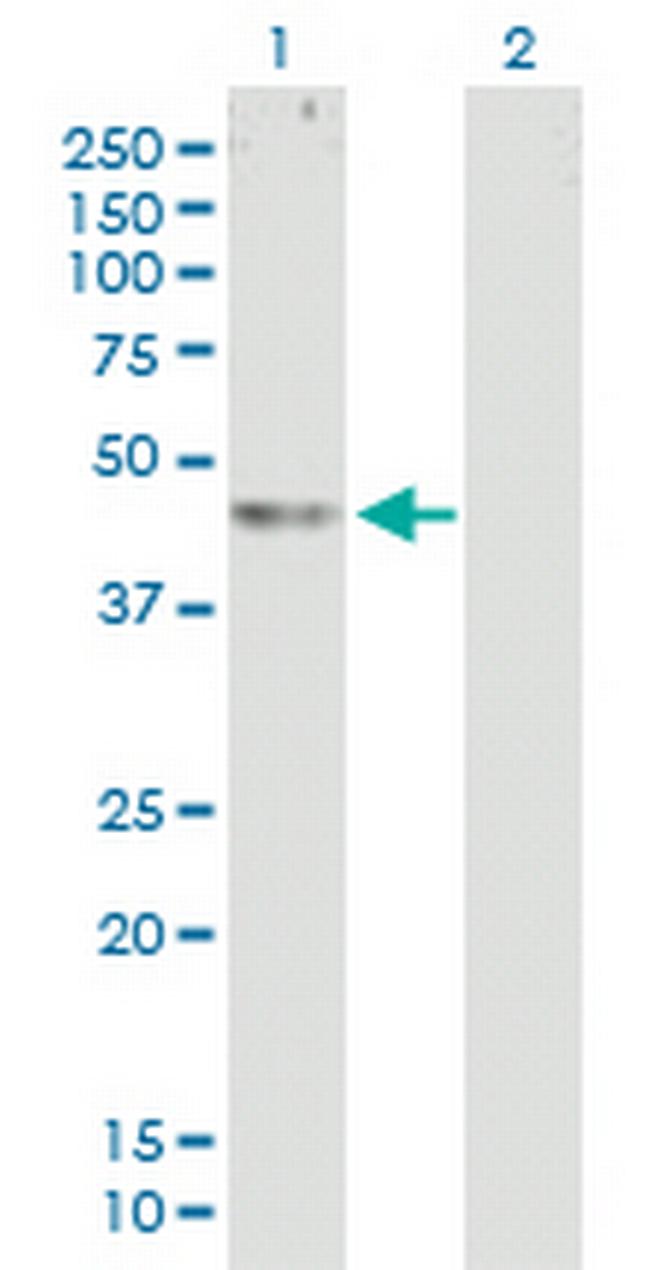 C20orf22 Antibody in Western Blot (WB)