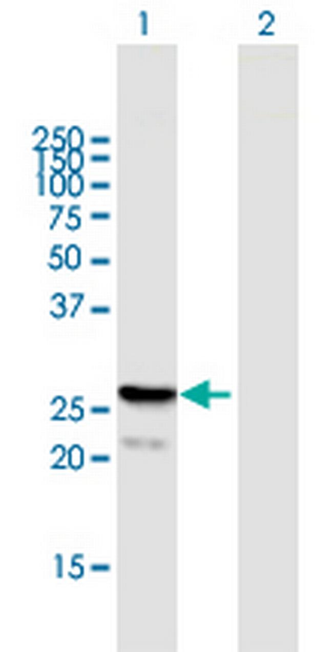 FGF21 Antibody in Western Blot (WB)