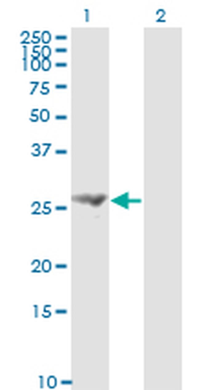 FGF21 Antibody in Western Blot (WB)