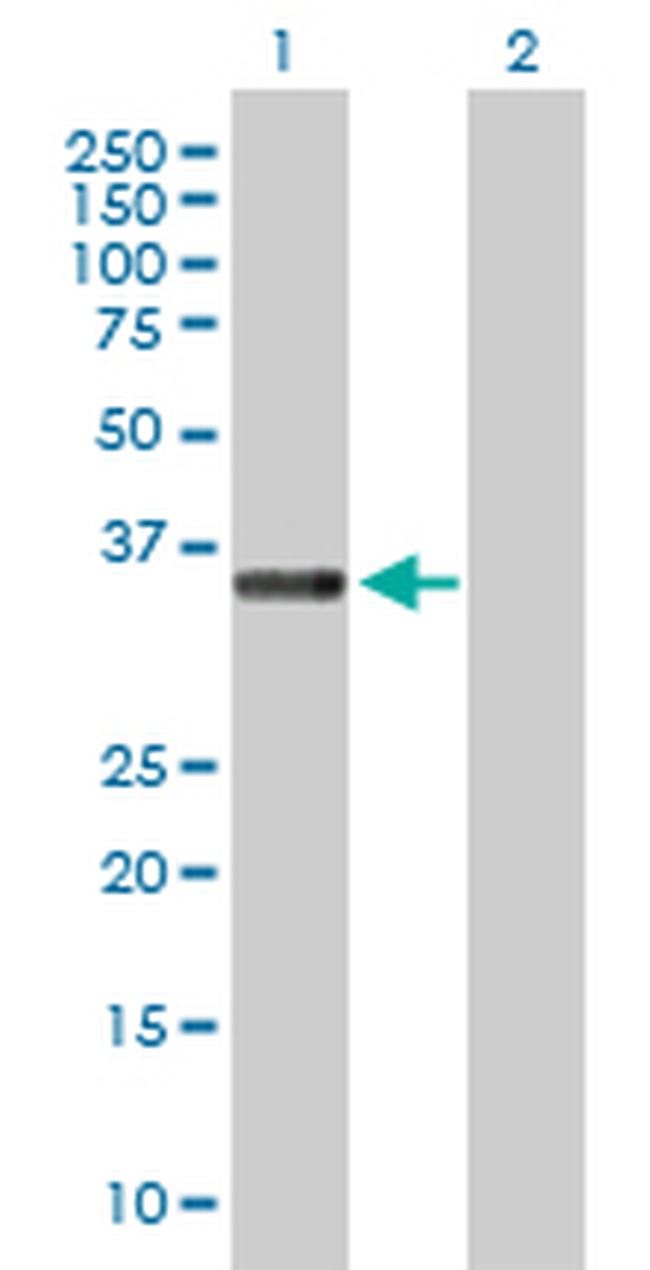 STEAP1 Antibody in Western Blot (WB)