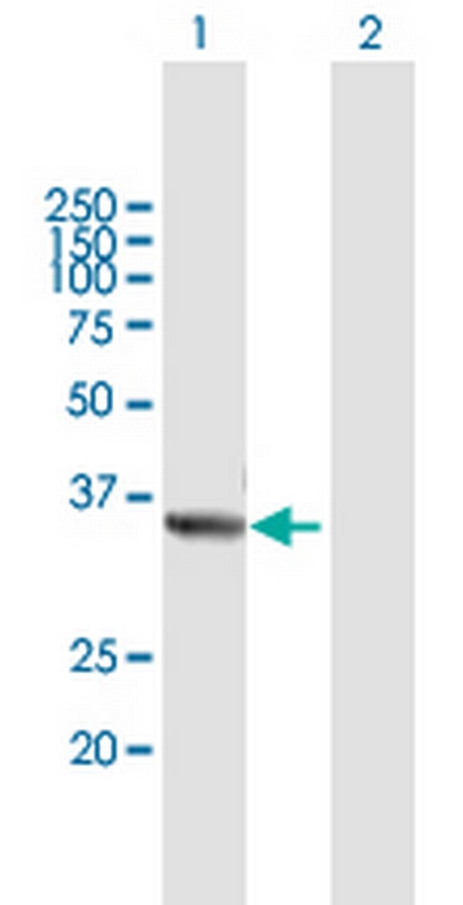 TRUB2 Antibody in Western Blot (WB)