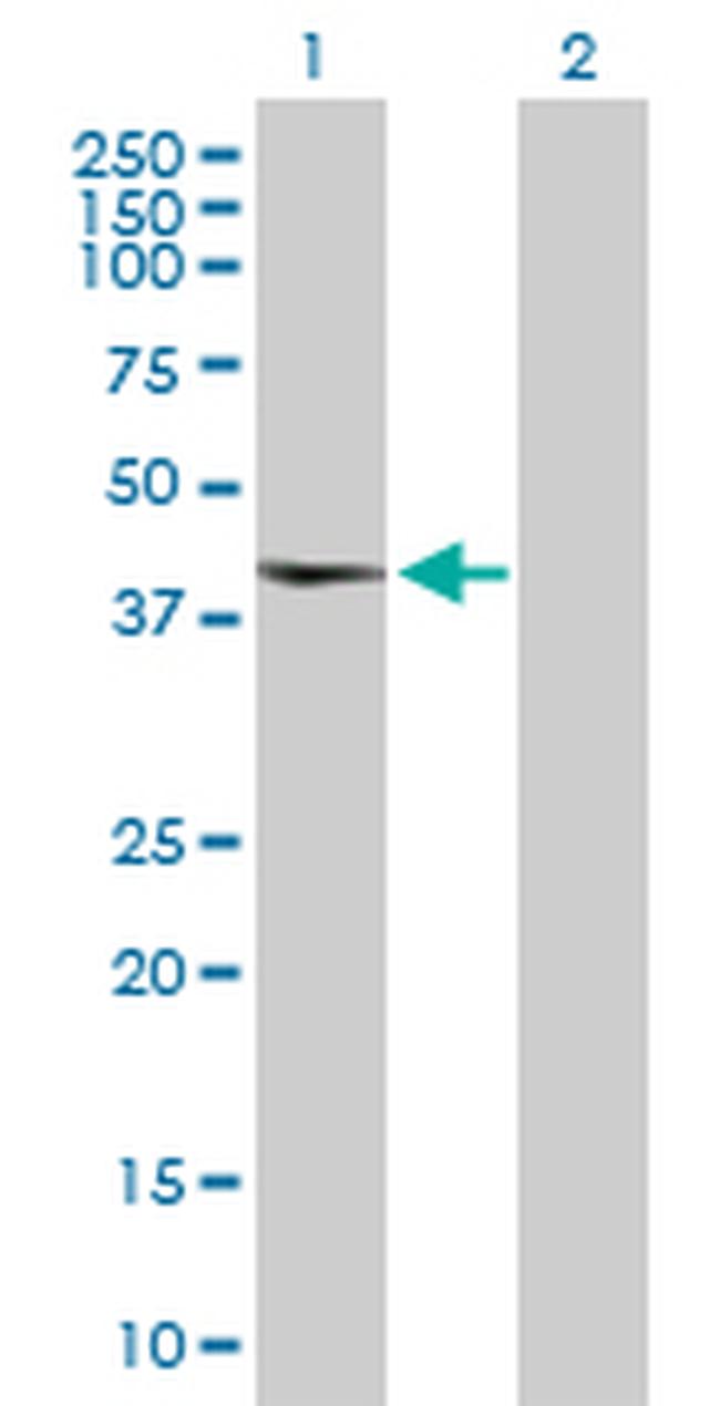 TAF5L Antibody in Western Blot (WB)