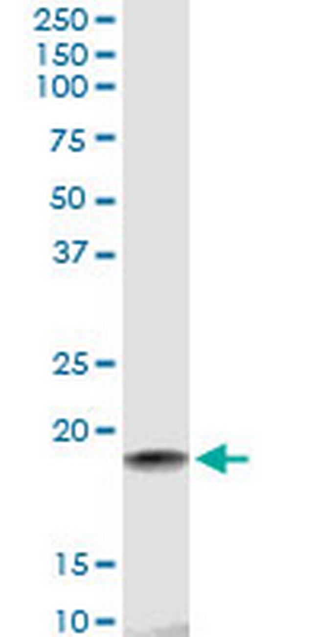 HSPB7 Antibody in Western Blot (WB)