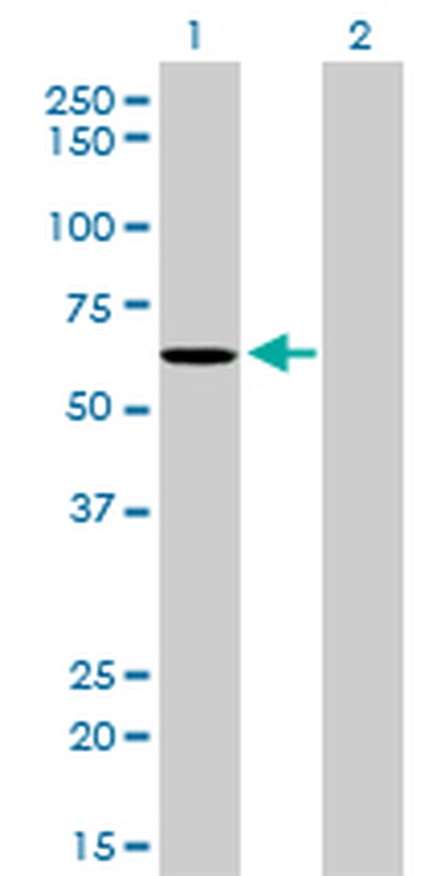 NDOR1 Antibody in Western Blot (WB)