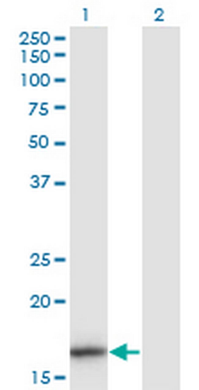 IL1F8 Antibody in Western Blot (WB)