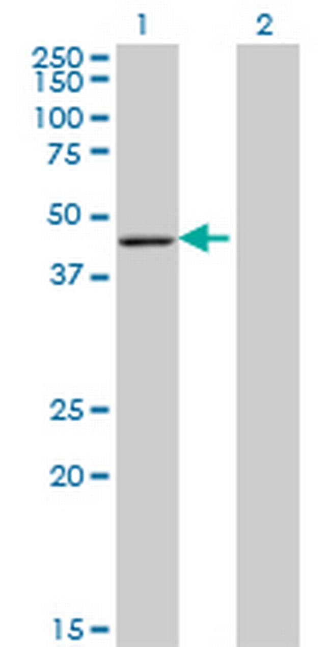 ARFIP1 Antibody in Western Blot (WB)