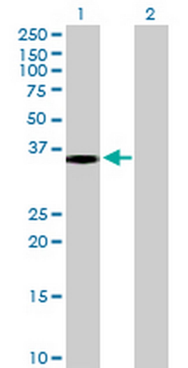 SULT1B1 Antibody in Western Blot (WB)