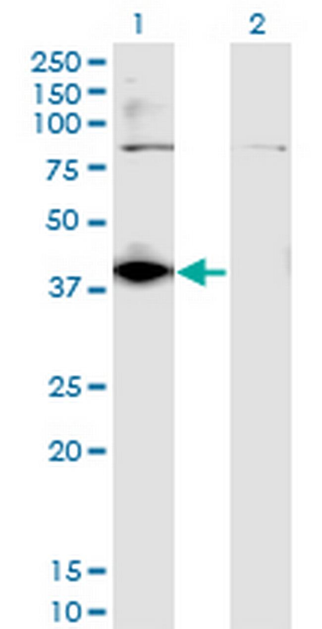 DHDH Antibody in Western Blot (WB)