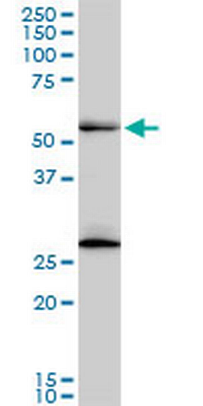 PRPF19 Antibody in Western Blot (WB)