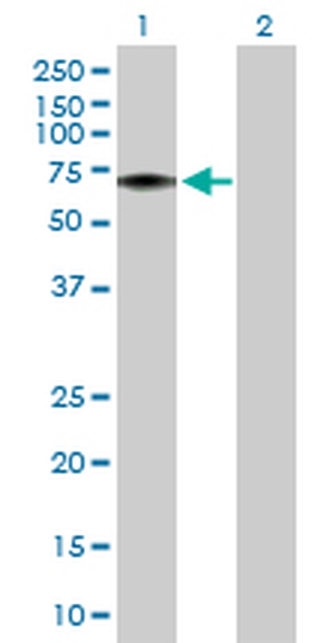 FLVCR1 Antibody in Western Blot (WB)