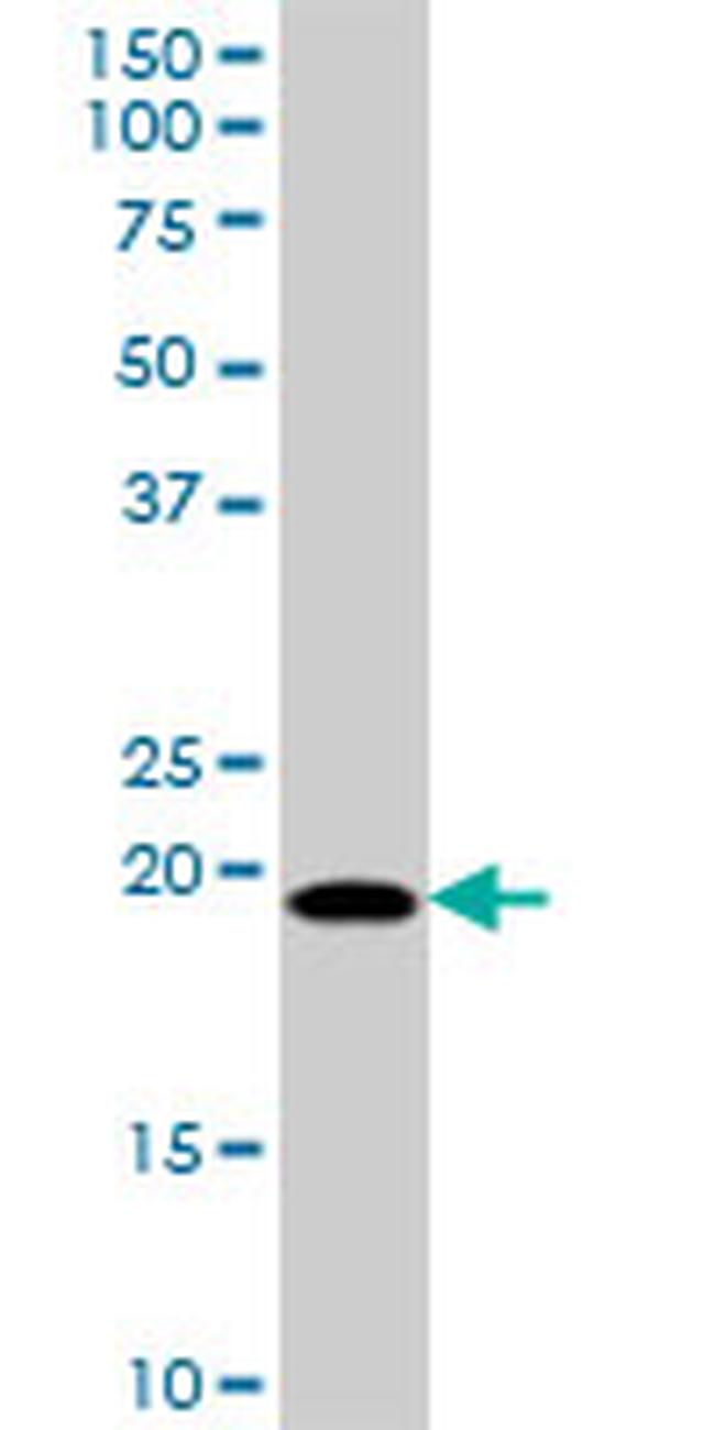 MRPL18 Antibody in Western Blot (WB)