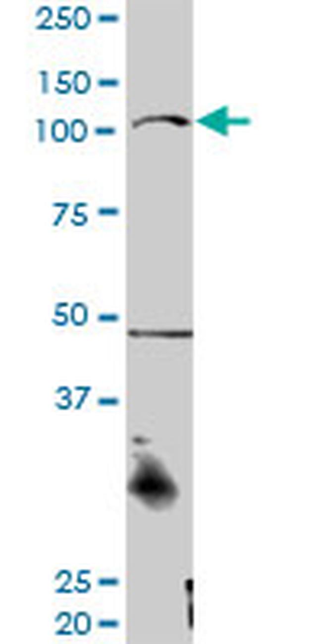 CTNNA3 Antibody in Western Blot (WB)