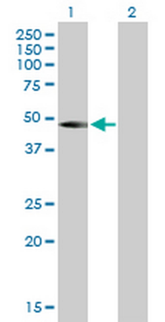 LMCD1 Antibody in Western Blot (WB)