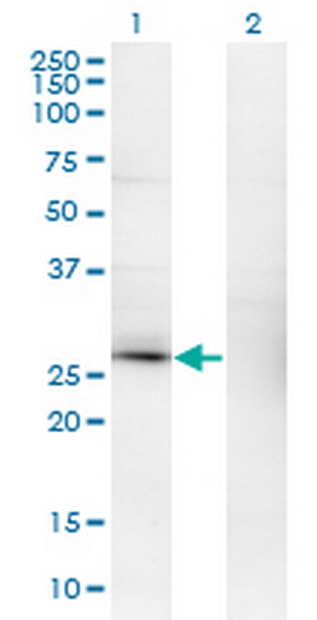 CSEN Antibody in Western Blot (WB)