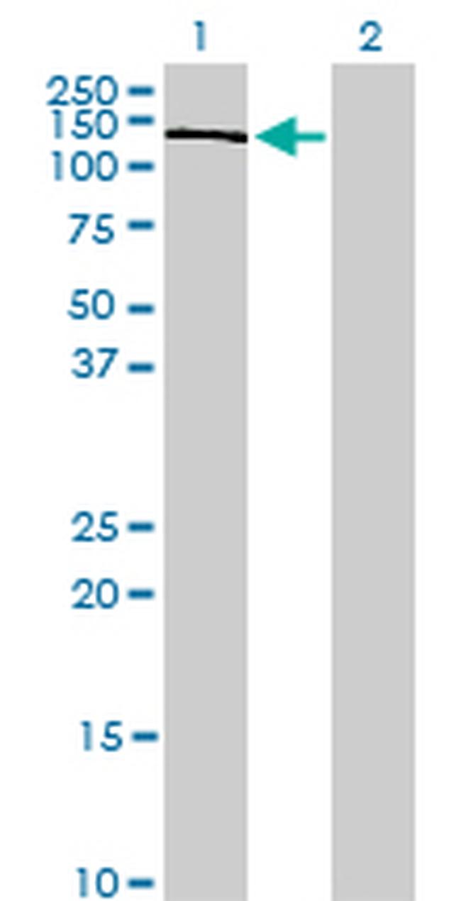 PIK3R4 Antibody in Western Blot (WB)