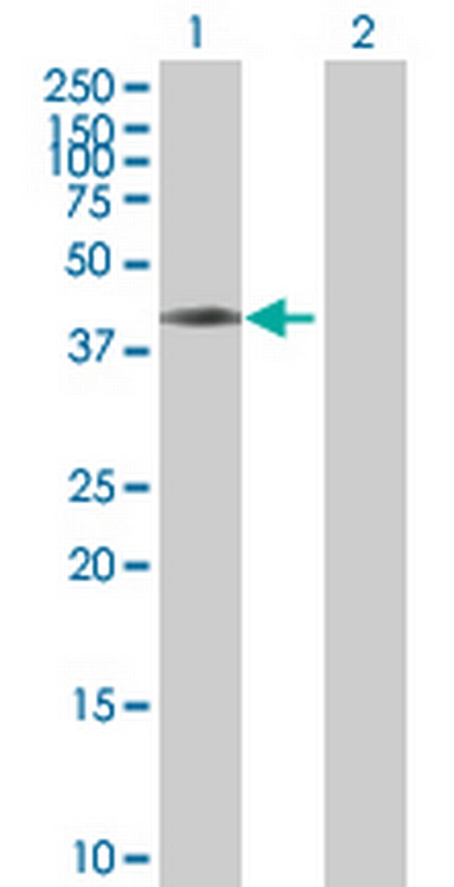 ASCC1 Antibody in Western Blot (WB)