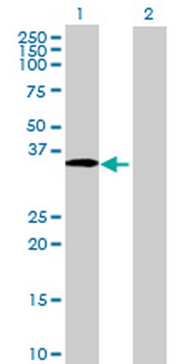 ZNF691 Antibody in Western Blot (WB)