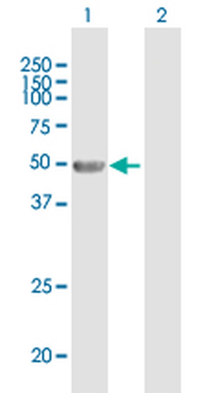 ANGPTL4 Antibody in Western Blot (WB)