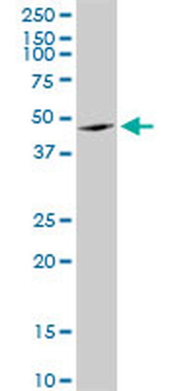 ANGPTL4 Antibody in Western Blot (WB)