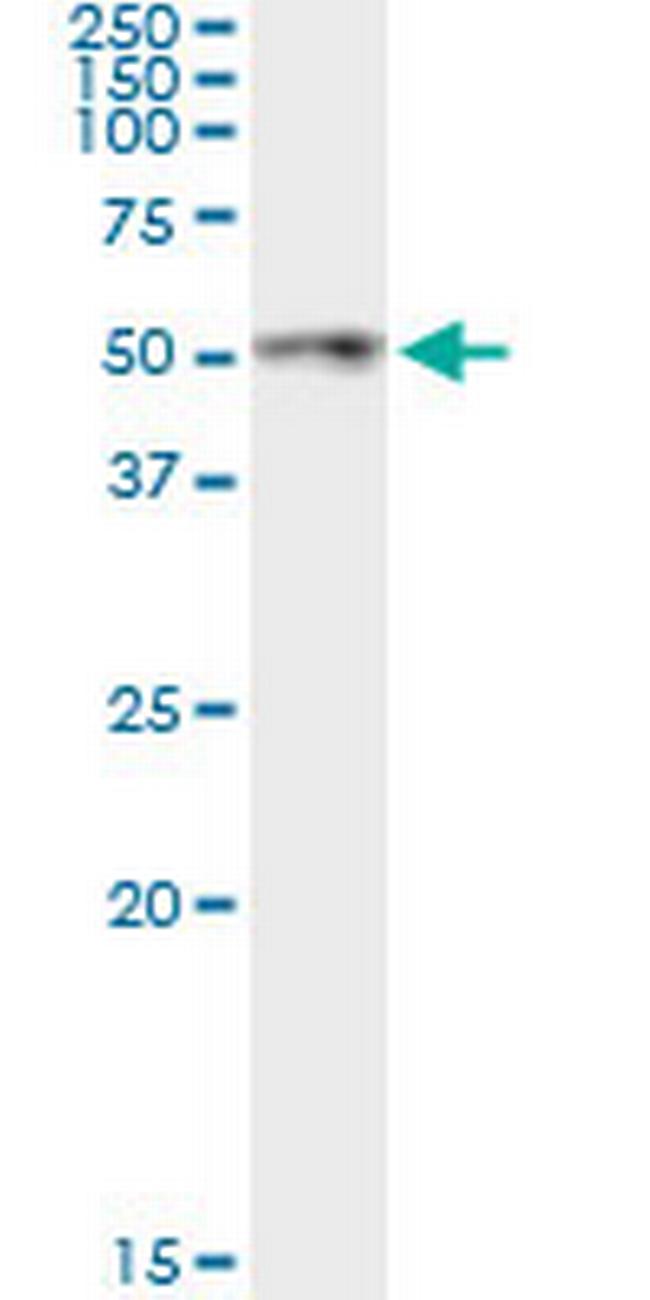 ANGPTL4 Antibody in Immunoprecipitation (IP)