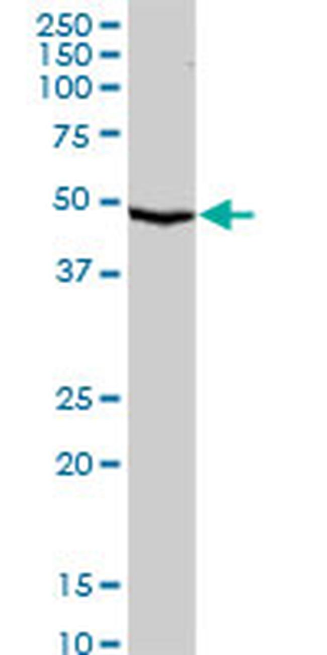 SERPINA10 Antibody in Western Blot (WB)