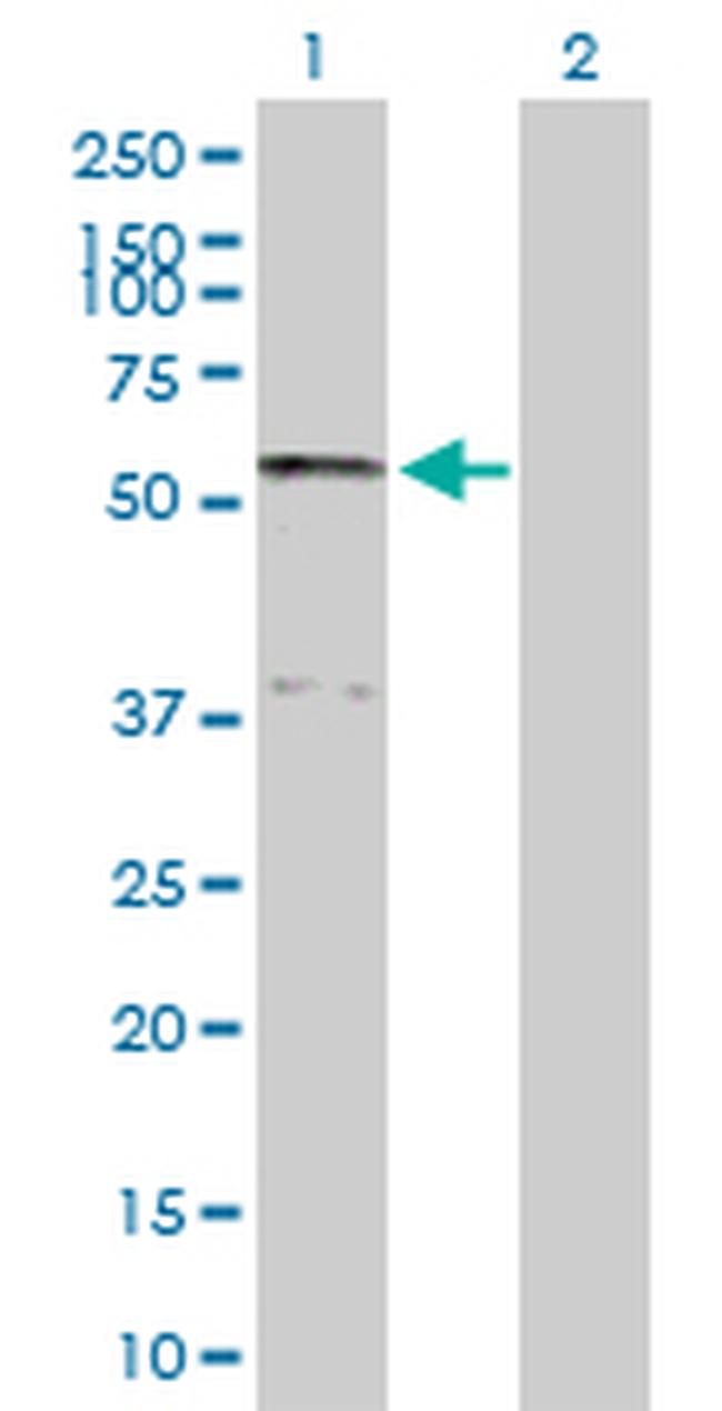 SERPINA10 Antibody in Western Blot (WB)