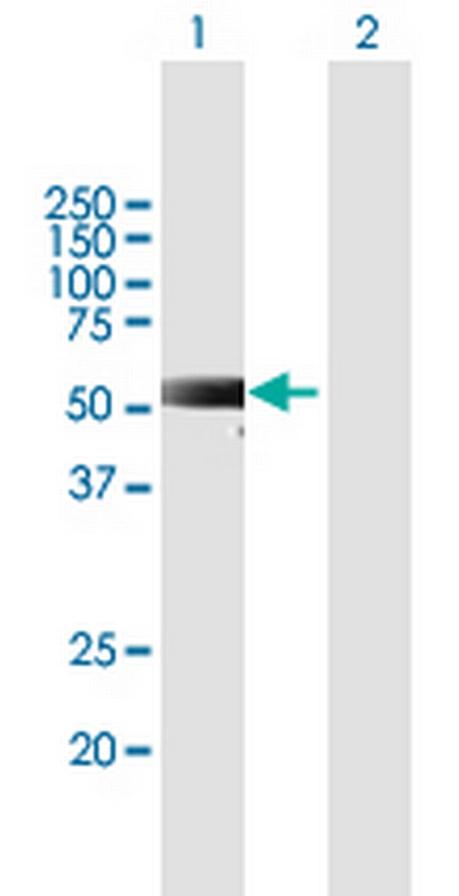 RKHD2 Antibody in Western Blot (WB)