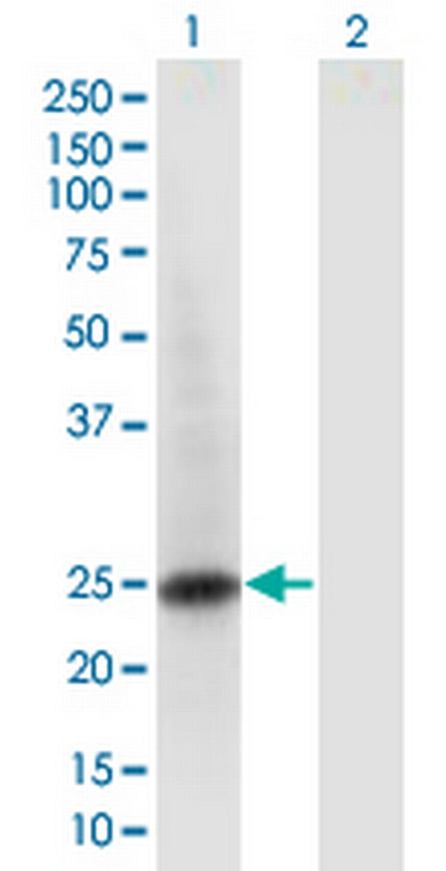 RAB6B Antibody in Western Blot (WB)