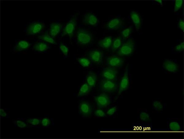 TRIM33 Antibody in Immunocytochemistry (ICC/IF)