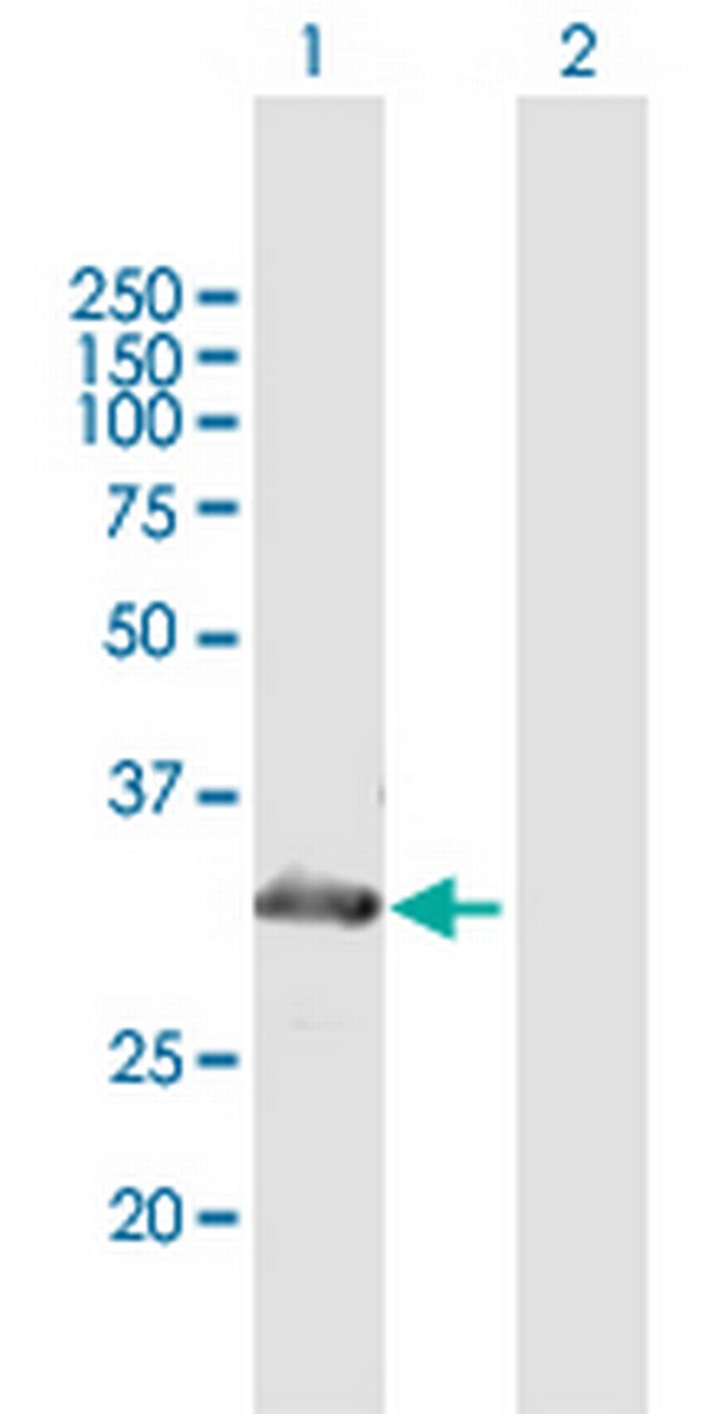 MYOZ2 Antibody in Western Blot (WB)
