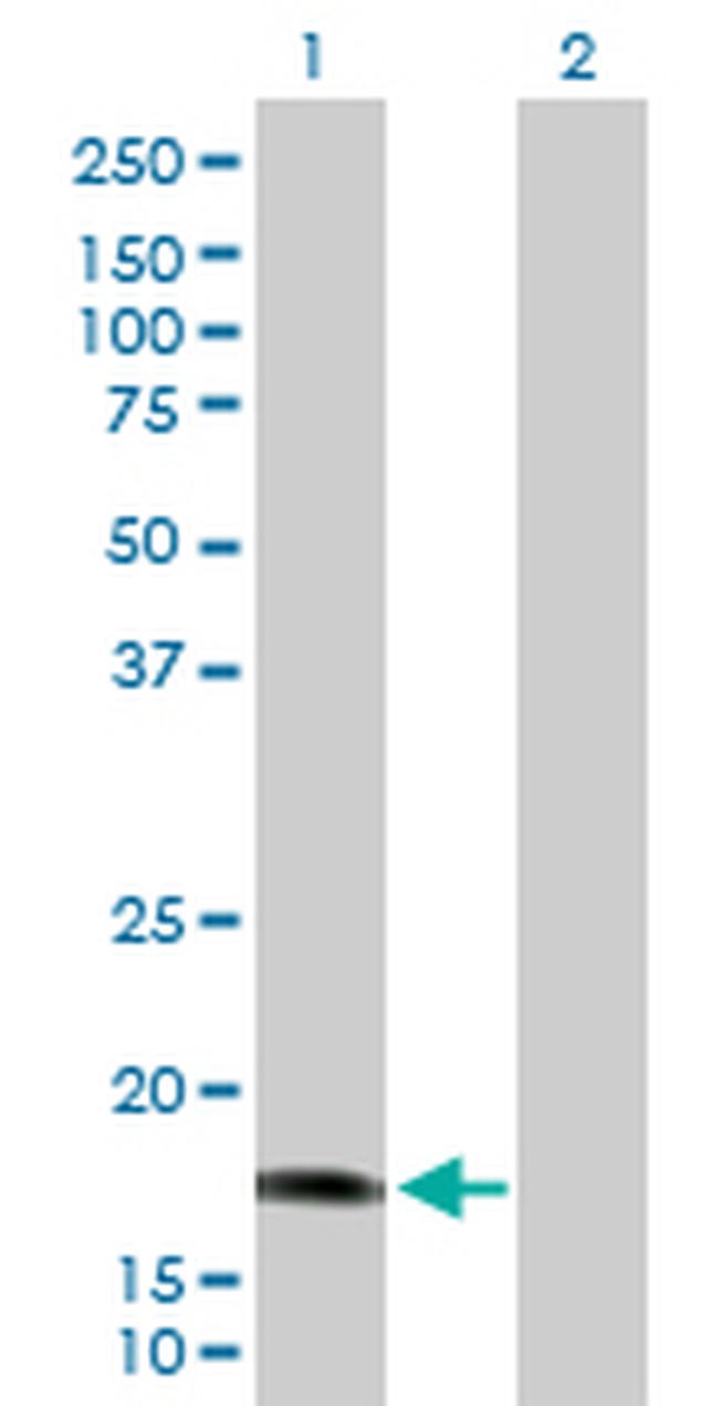 CALML5 Antibody in Western Blot (WB)