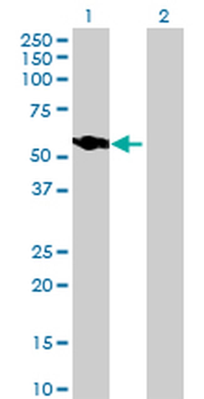 NUP54 Antibody in Western Blot (WB)