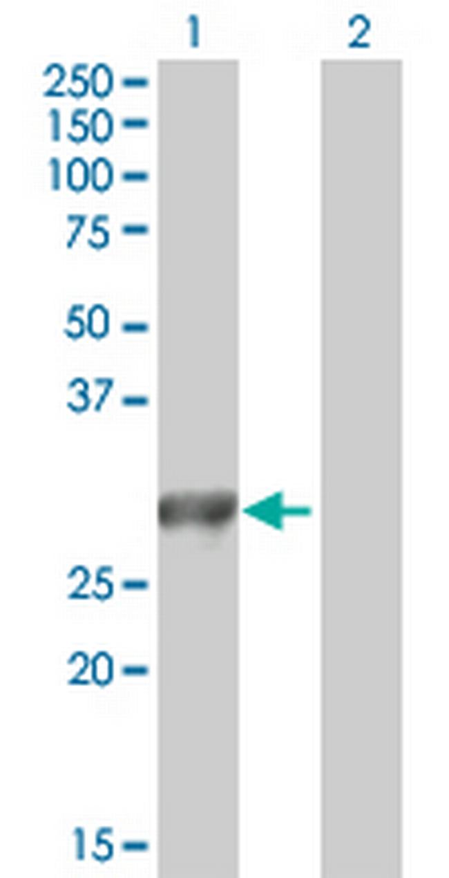 MYO3A Antibody in Western Blot (WB)