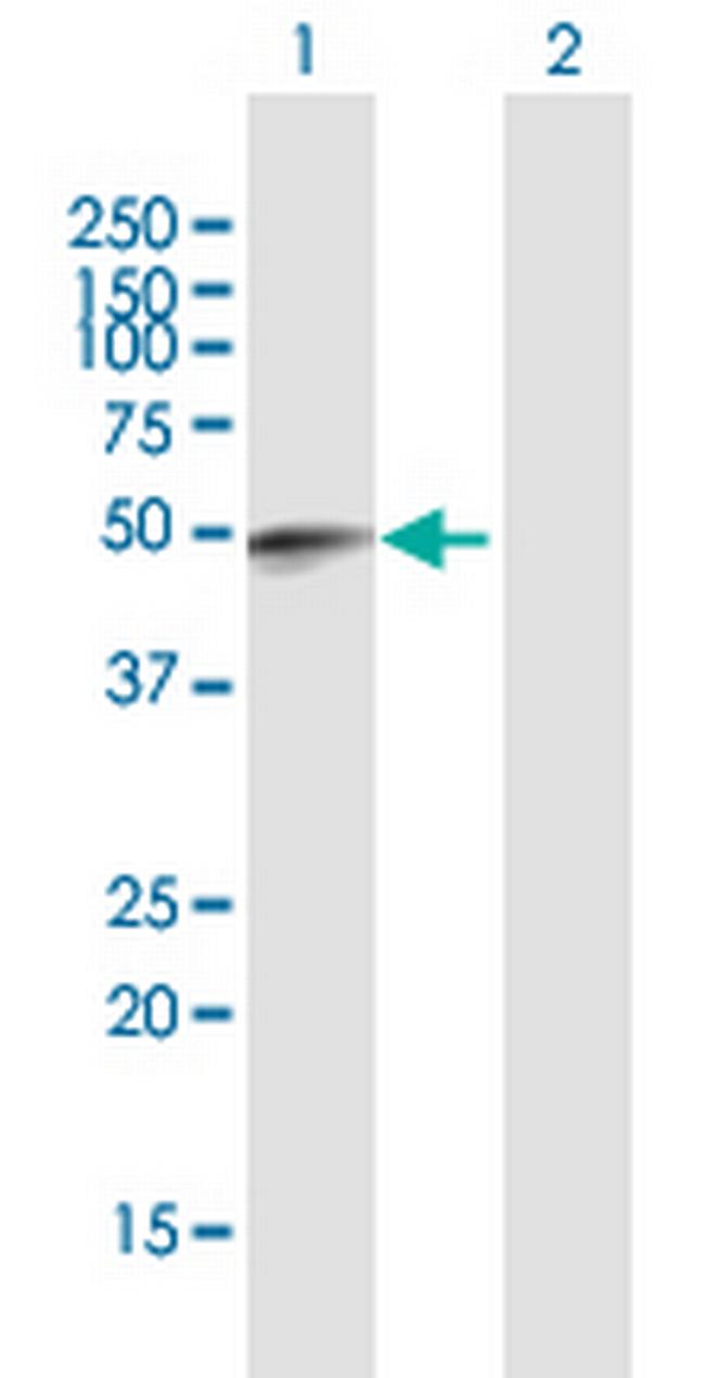 FAM134B Antibody in Western Blot (WB)