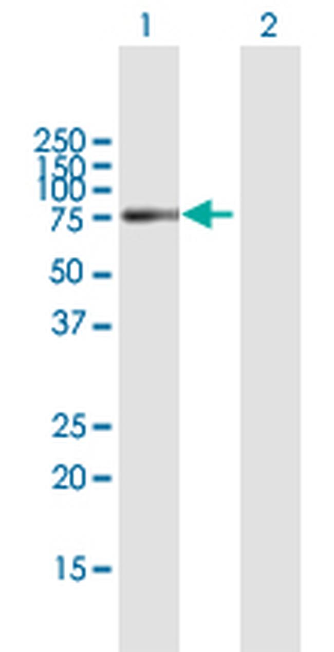 NBLA00058 Antibody in Western Blot (WB)