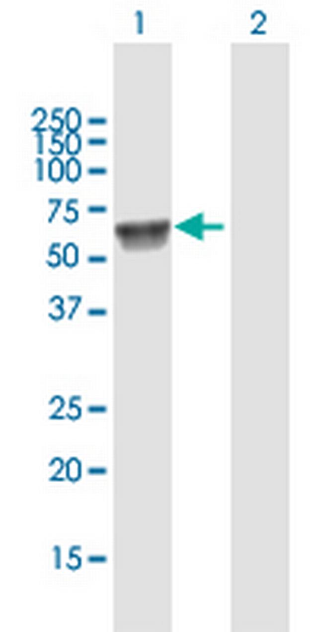 UGT1A7 Antibody in Western Blot (WB)