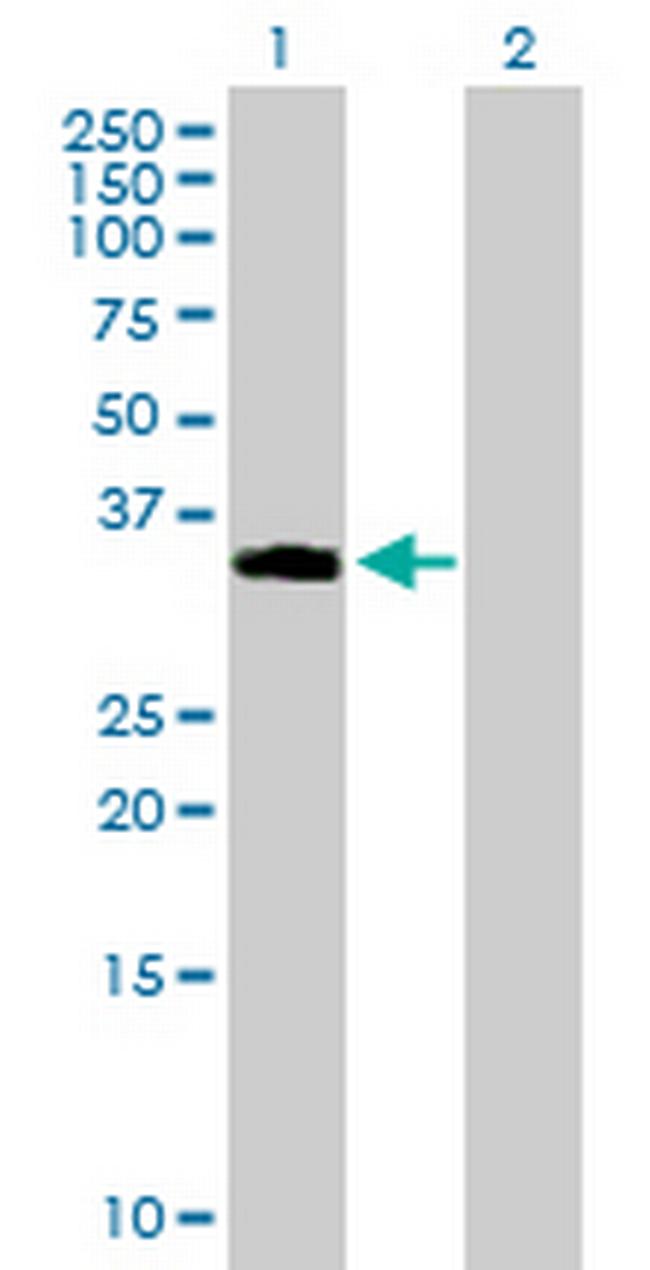 NDFIP2 Antibody in Western Blot (WB)