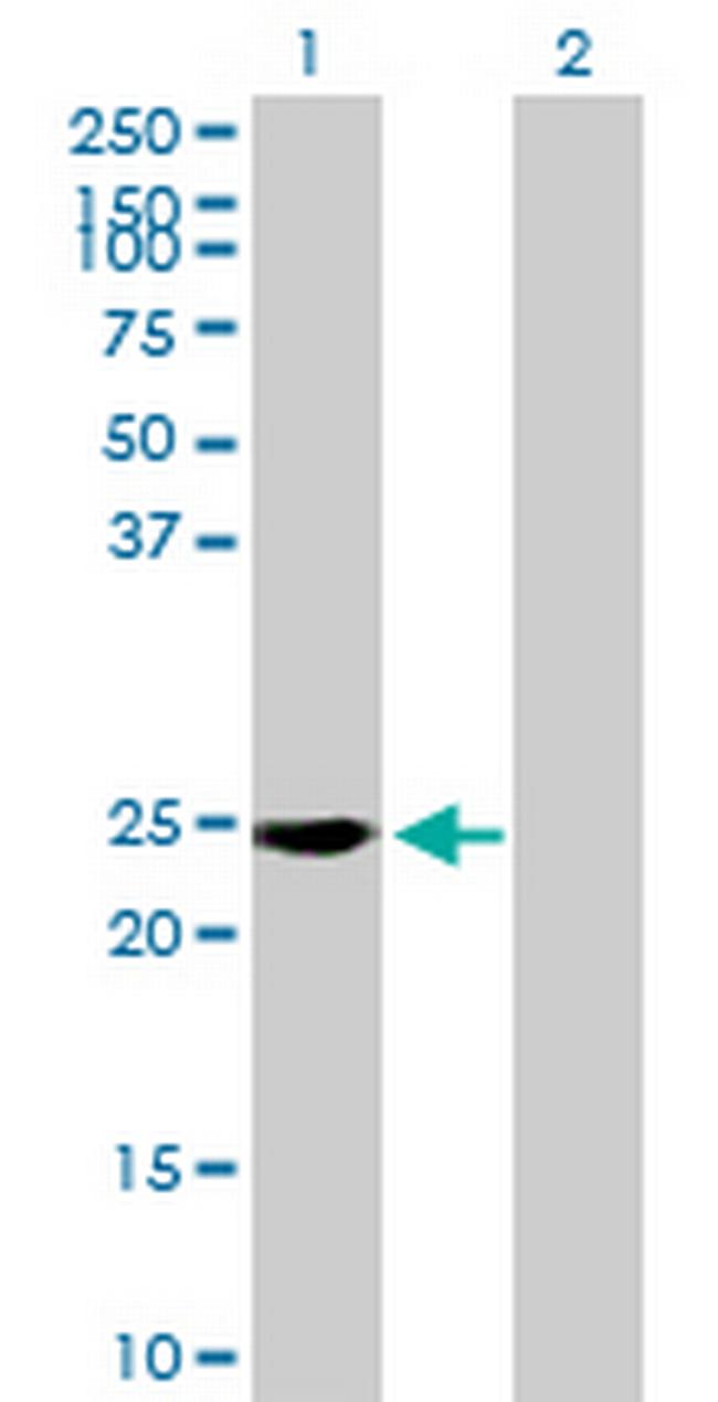 RAB39 Antibody in Western Blot (WB)