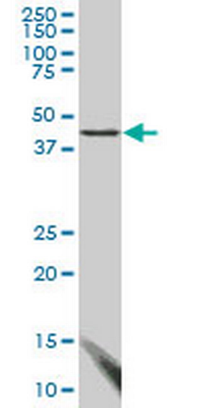 FBLIM1 Antibody in Western Blot (WB)