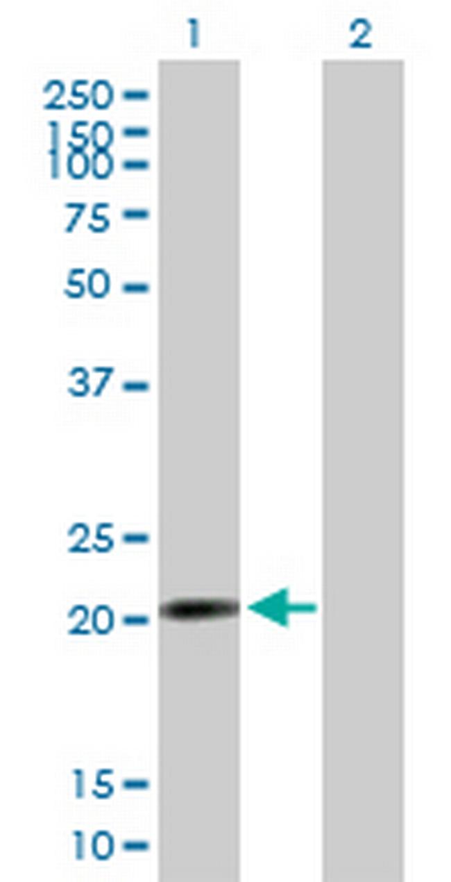 RP13-383K5.2 Antibody in Western Blot (WB)