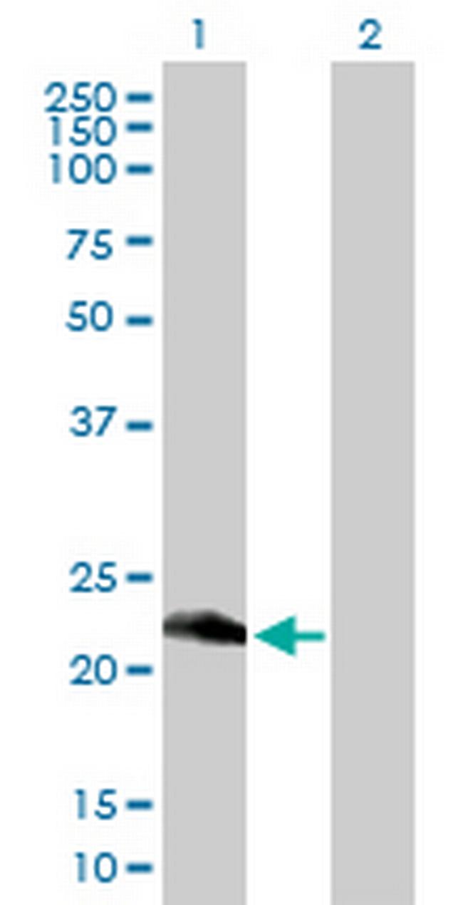 RETSAT Antibody in Western Blot (WB)