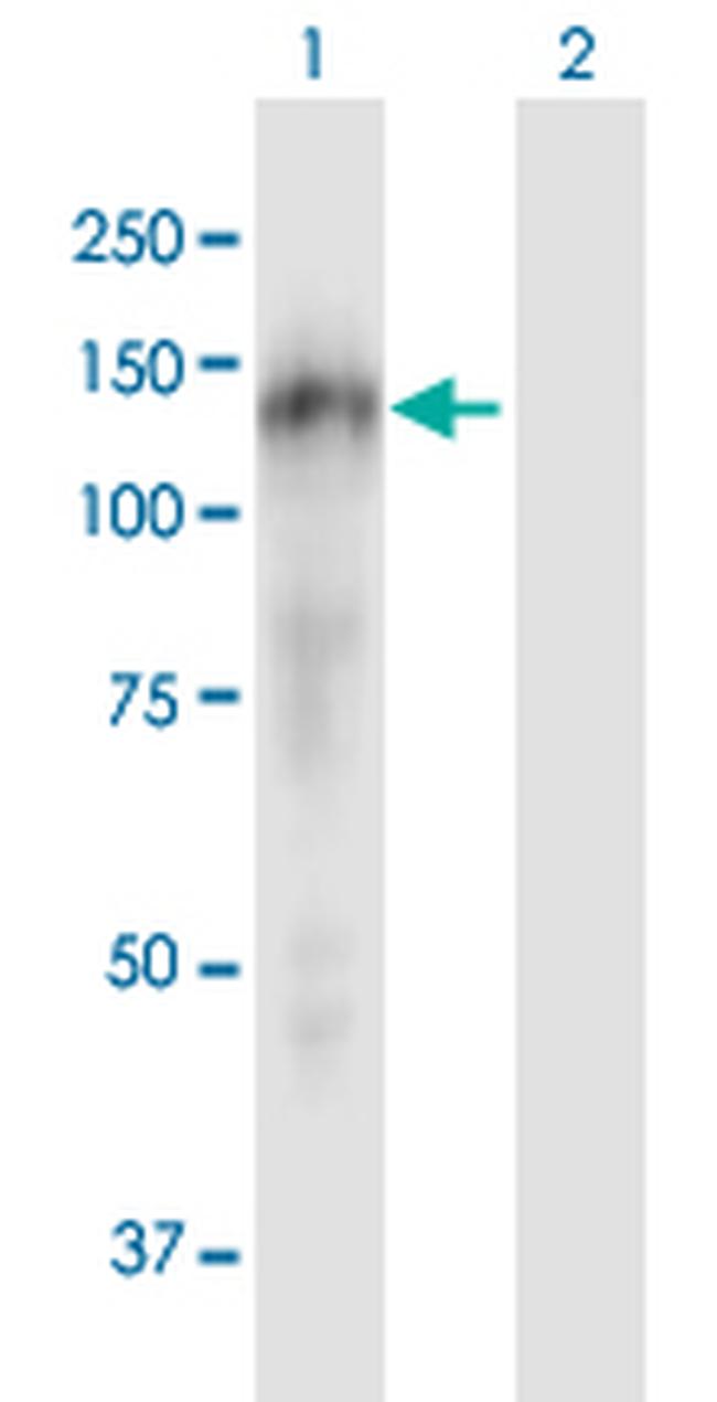 CASZ1 Antibody in Western Blot (WB)