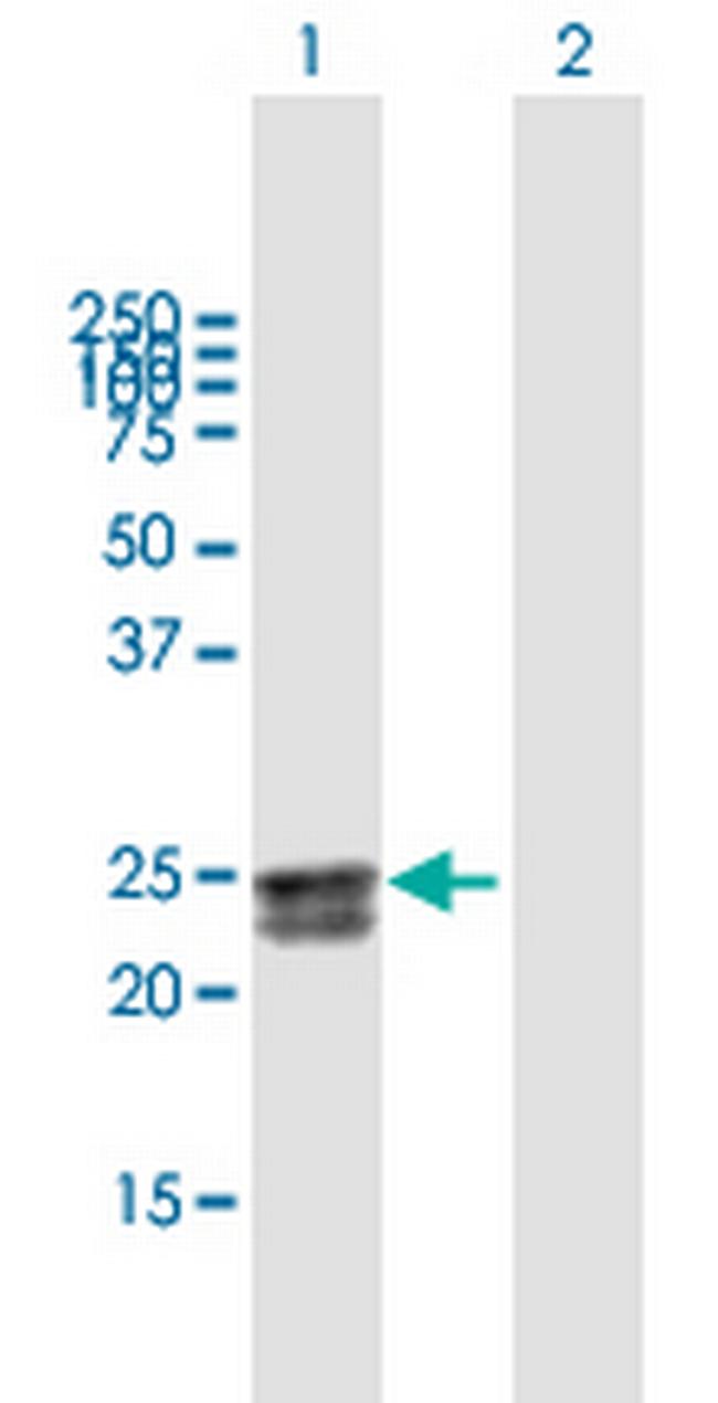 FLJ20397 Antibody in Western Blot (WB)