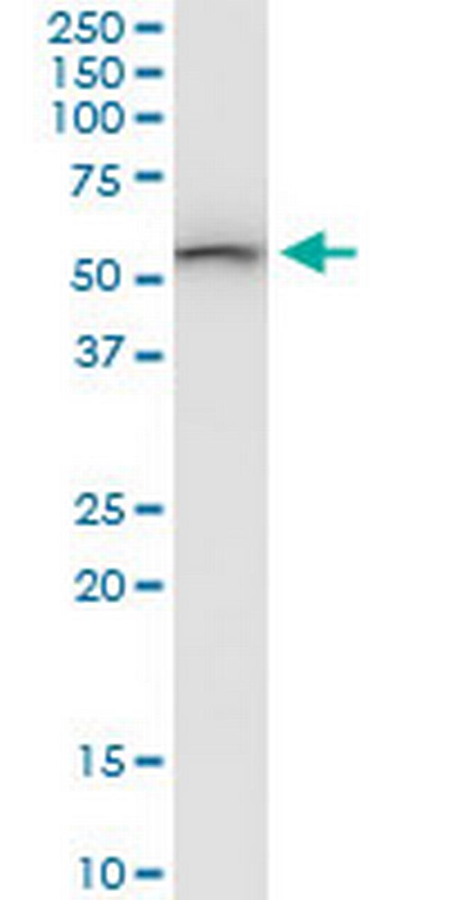 SARS2 Antibody in Western Blot (WB)