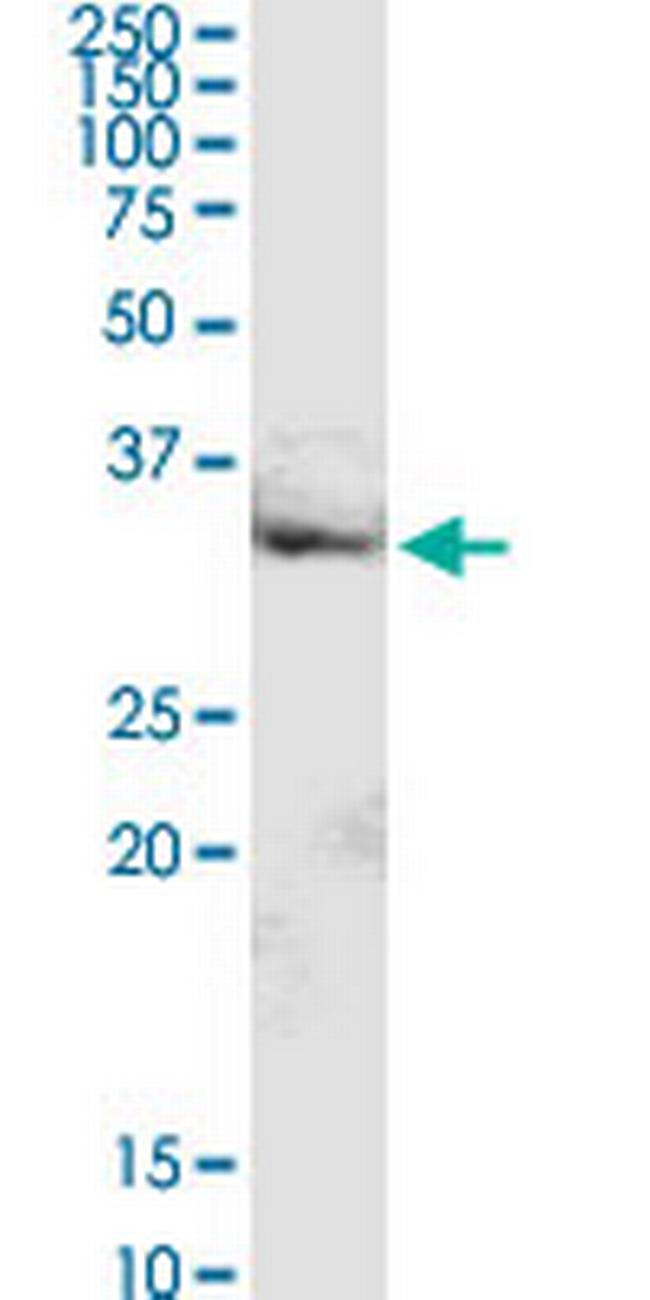 MRPL16 Antibody in Western Blot (WB)