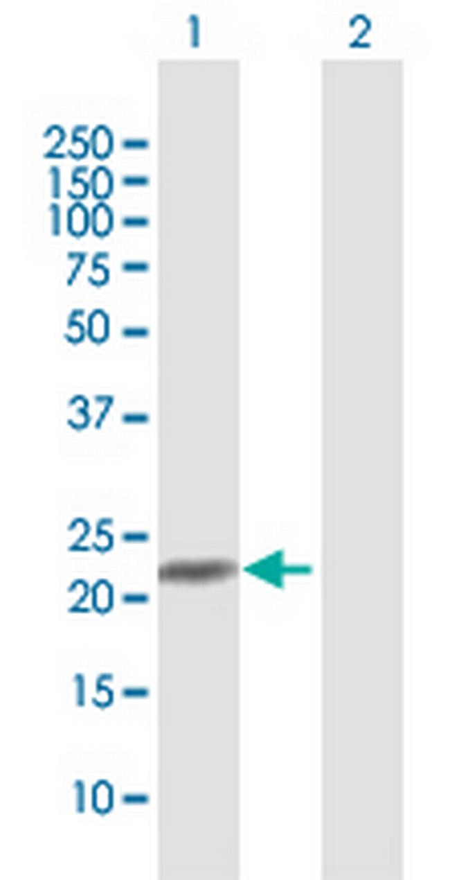 C9orf95 Antibody in Western Blot (WB)