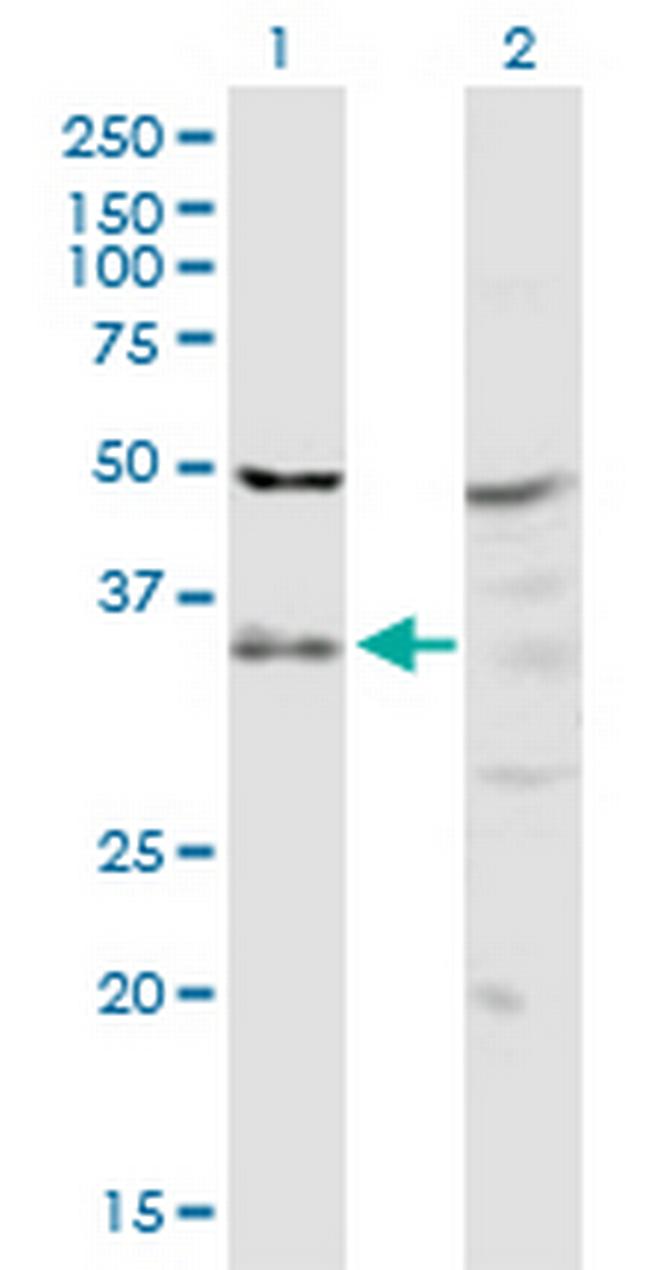 PIH1D1 Antibody in Western Blot (WB)