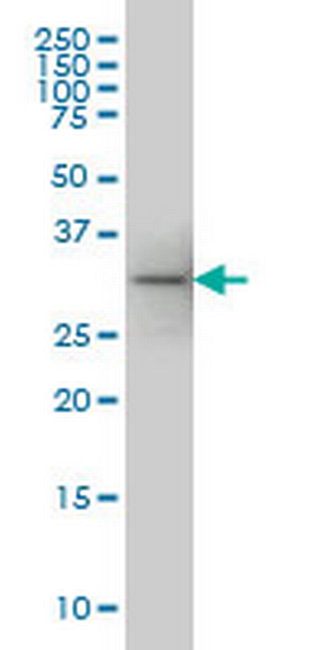 FLJ20643 Antibody in Western Blot (WB)